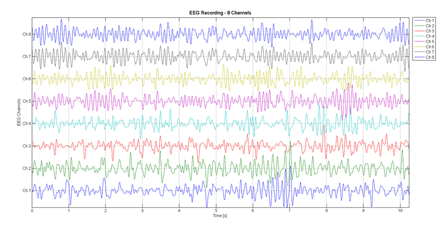 Objective-measurement-of-listening-effort_EEGrec8Chan