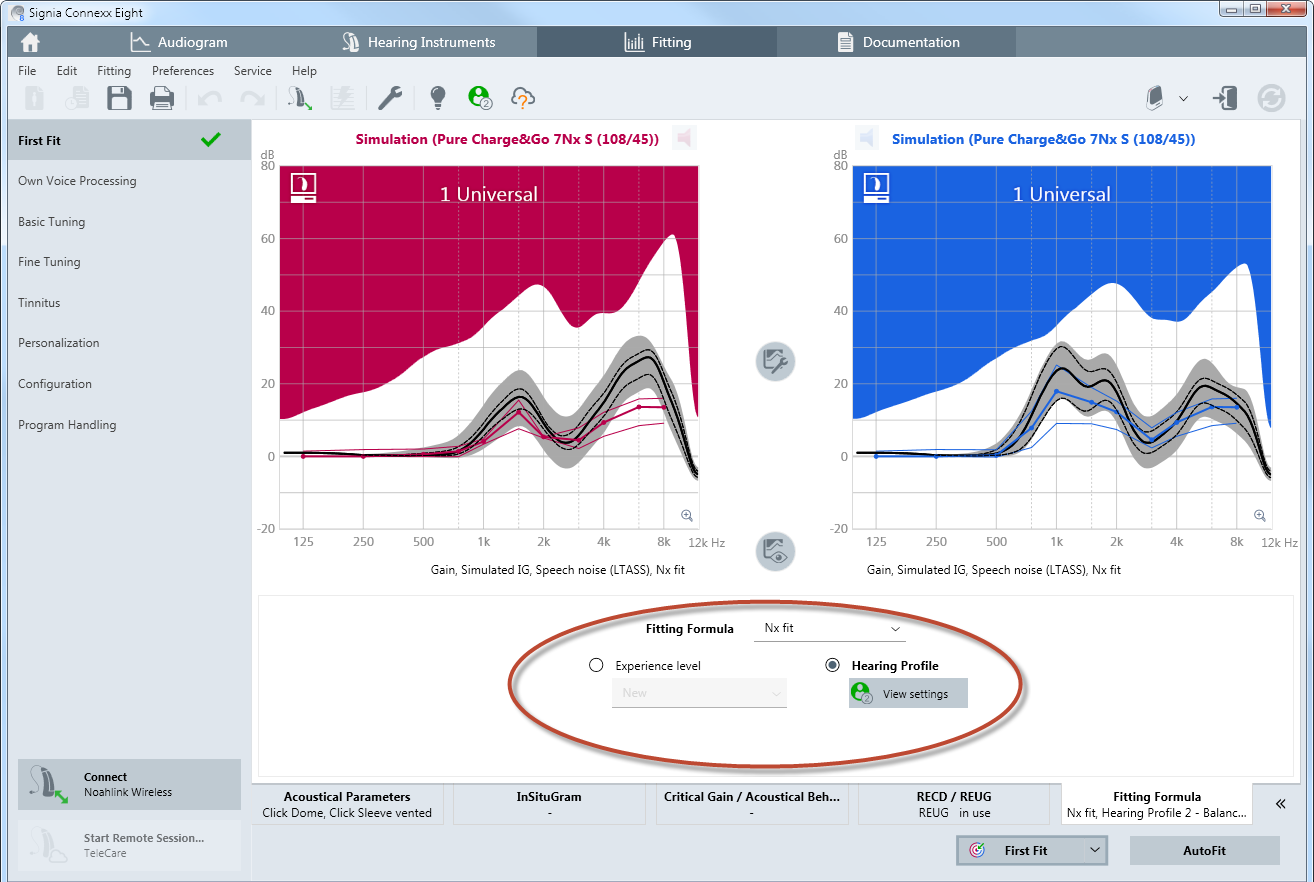 Before starting the AutoFit procedure, the desired prescription formula and user experience level should be selected. There is a choice of 1/3 gain, NAL-NL1, NAL-NL2, DSL-v5 and proprietary fitting formula as e.g. Nx-Fit (Figure 4).