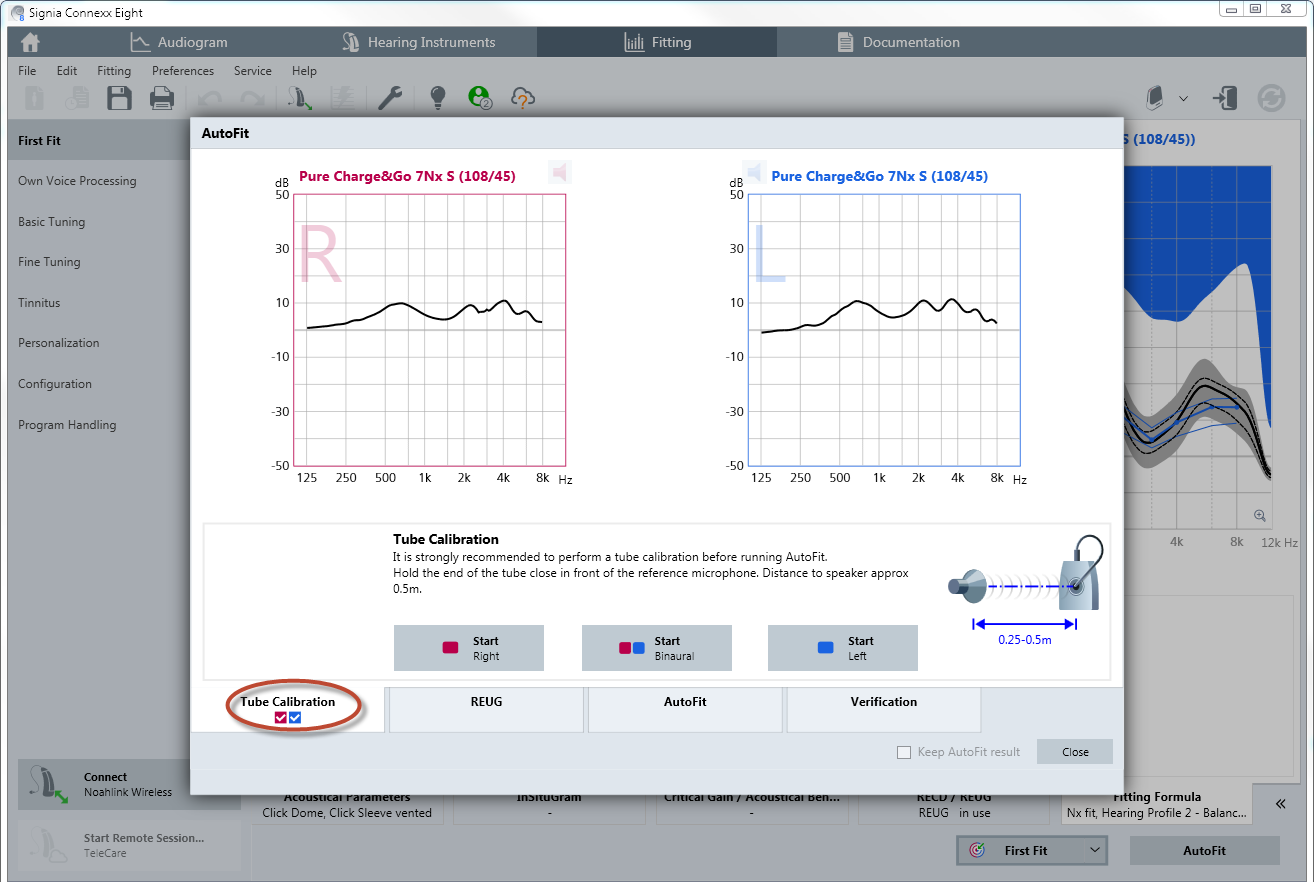 The probe-tube calibration is necessary before the real-ear measurement is performed. If you are using a different probe assembly for the right and left ears, then both will need to be calibrated separately. Click either on “Start Right” or “Start Left” or “Start Binaural” to initiate the measurement. Follow the instructions shown on the Connexx screen regarding the calibration. Connexx will automatically check if the calibration is within the tolerable range.