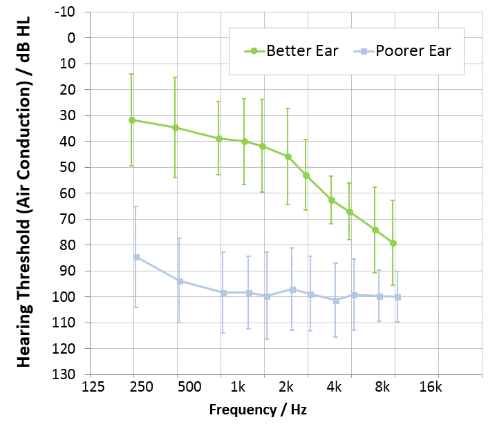 To assess the effectiveness and feasibility of Narrow Directionality with Pure Nx instruments and the new Silk Nx instruments for listeners with SSD, a clinical study with 12 participants was conducted.  The participants had profound hearing loss on one side, and slight to moderate hearing loss on the other side. The average audiogram for the patients is shown in Figure 1. Eight male and four female participants were tested, with ages ranging from 63 to 91 years; mean age was 75 years. BiCROS fittings were tested using Signia CROS Pure 312 Nx and Silk Nx CROS hearing aids. Coupling to the ear was accomplished by using standard Signia closed Click Sleeves. The hearing instruments were fitted to the individual audiogram of the patient using the NxFit fitting formula for experienced hearing aid users. All sound processing features were left at the default settings. The results of the BiCROS fittings were compared to results obtained with a conventional monaural fitting on the better ear.