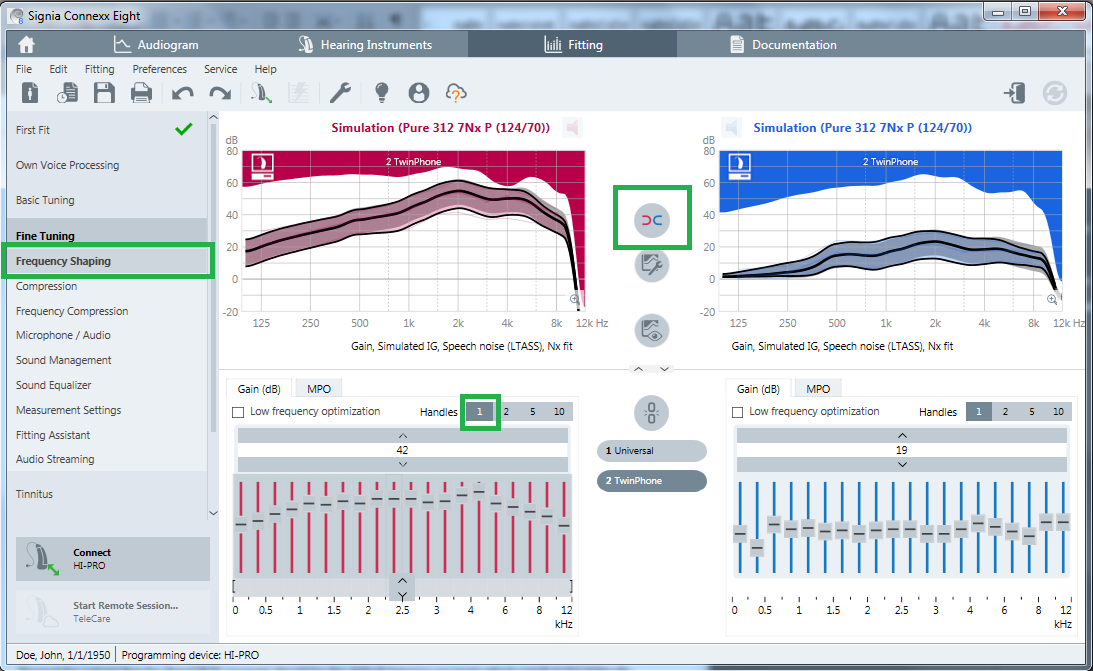 Return to Fine Tuning and select Frequency Shaping to make any gain adjustments as necessary. Select 1 or 2 Handles to make overall gain adjustments more efficient. Ensure that the two hearing aids are not coupled by clicking on the first round button between the curve views so that changes made here will only affect one side. It is likely that in the poorer hearing ear the patient may find that sounds are too distorted or too soft. Decrease overall gain if the patient reports distortion or poor sound quality. Increase overall gain if sounds are inaudible in the poorer hearing ear.