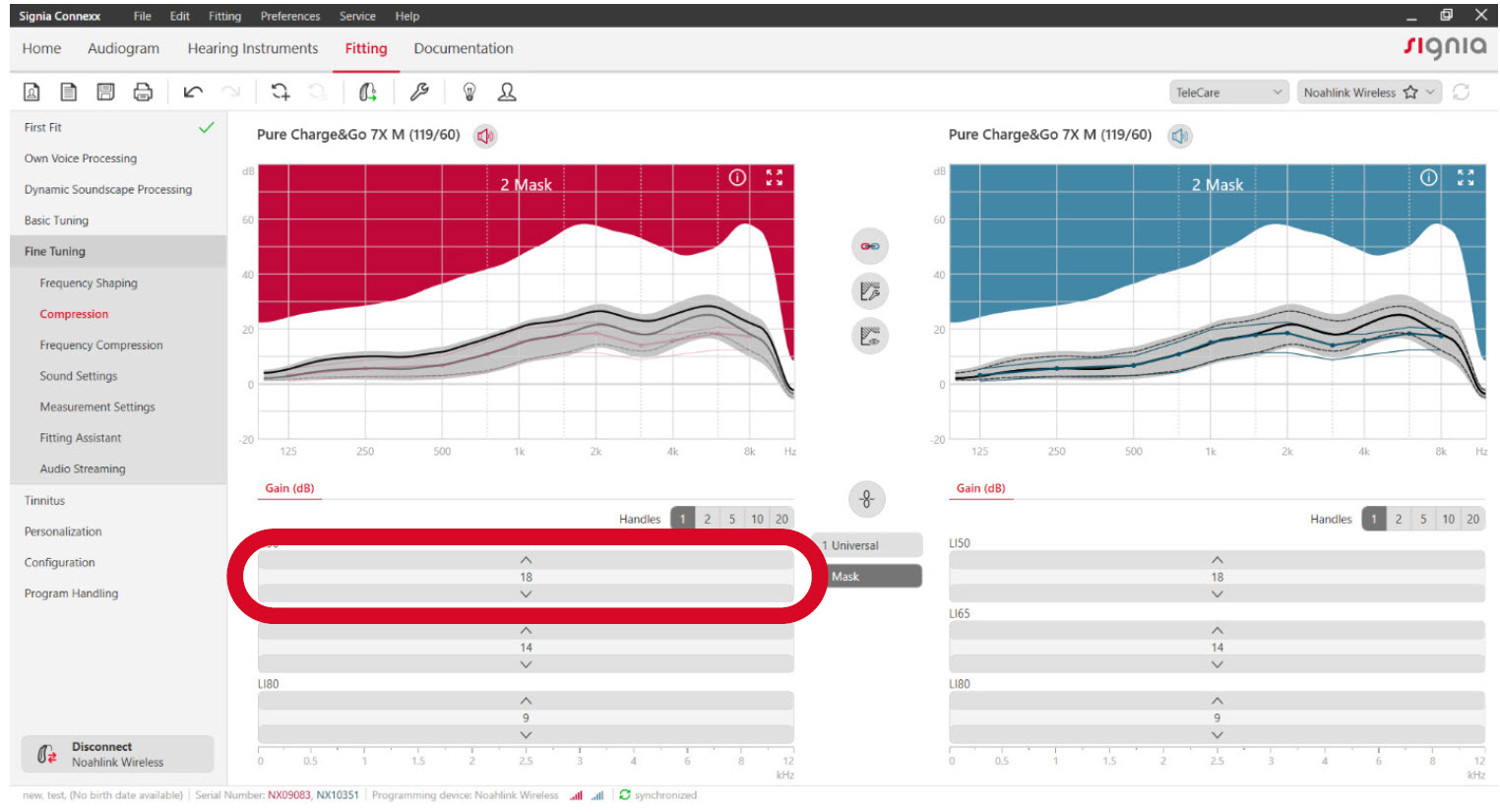 Under Compression, increase LI50 gain by 2 dB in all channels.